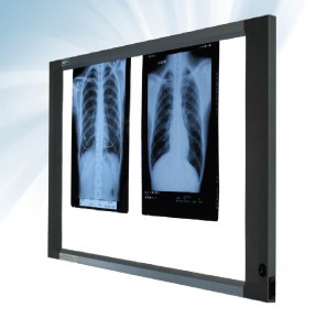 Slim x-ray film viewe Cablas