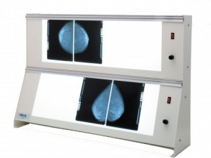 X-ray film viewer for mammography high frequency Cablas